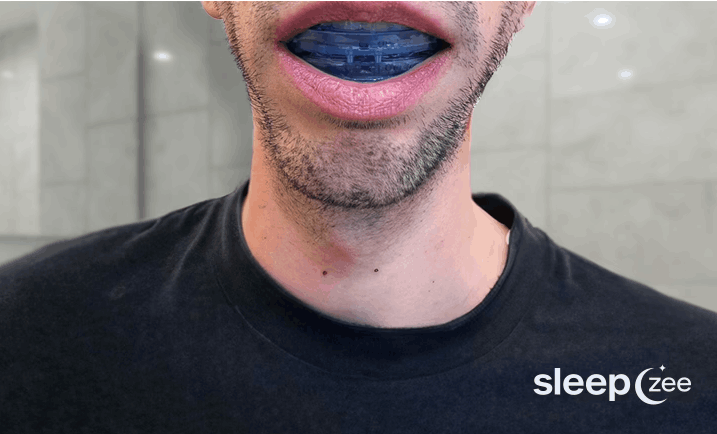 SleepZee Anti-Snoring Mouthpiece
